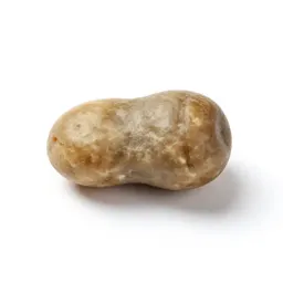 Gallstone