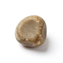 Kidney stone
