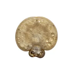 Bladder stone