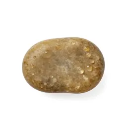 Gallstone