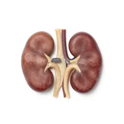 Kidney stone