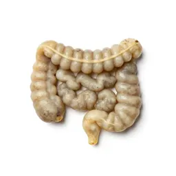 Enterolith